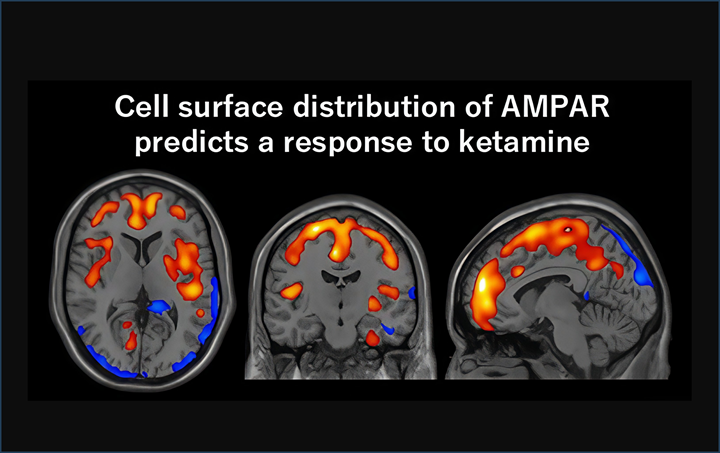 Ketamine's Rapid Antidepressant Action Revealed Through PET Imaging