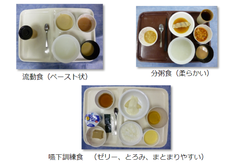 食事の種類、形態についての画像