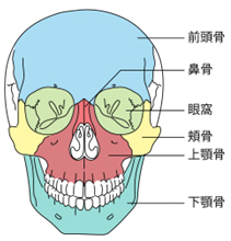 顔面骨骨折