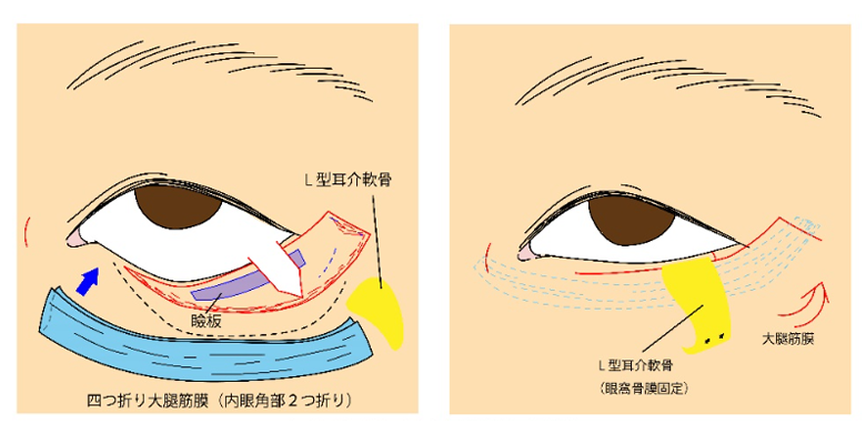 下眼瞼（したまぶた）