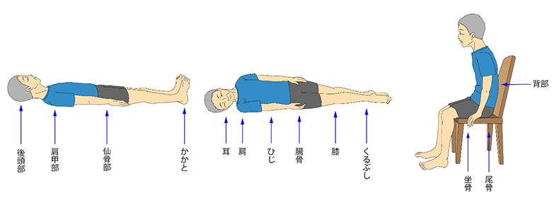 褥瘡のできやすい部位