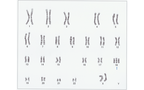 染色体検査