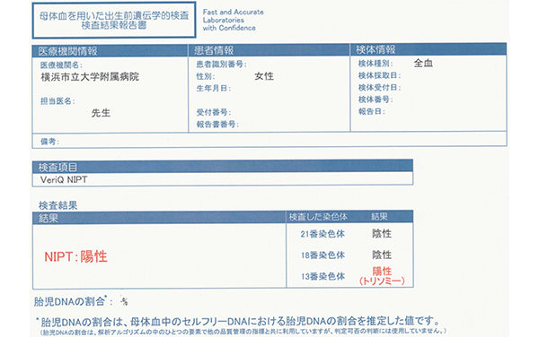 NIPT(非侵襲性出生前遺伝学的検査)画像