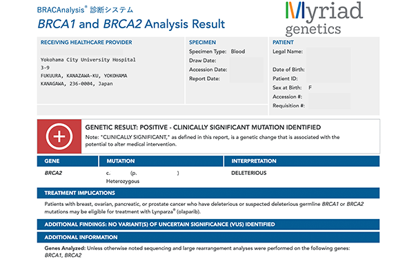 BRCA検査画像