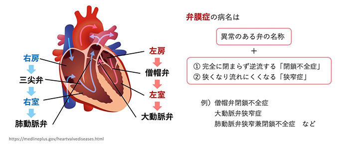 心臓の血流の仕組みと弁膜症の種類を示した図