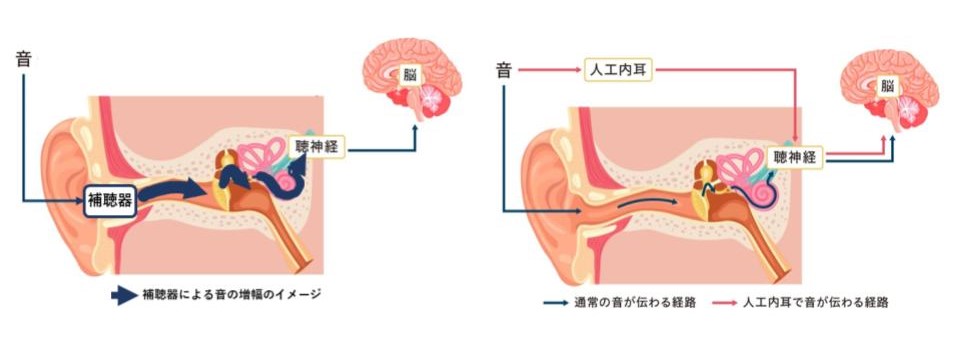 音の経路の模式図