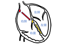 正常の説明図