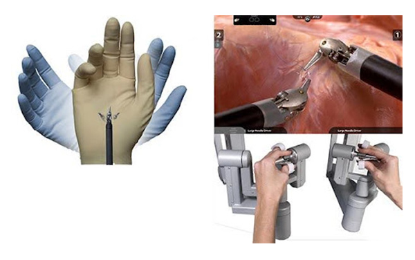 ロボット支援下腎部分切除術(ダ・ヴィンチ)イメージ画像2