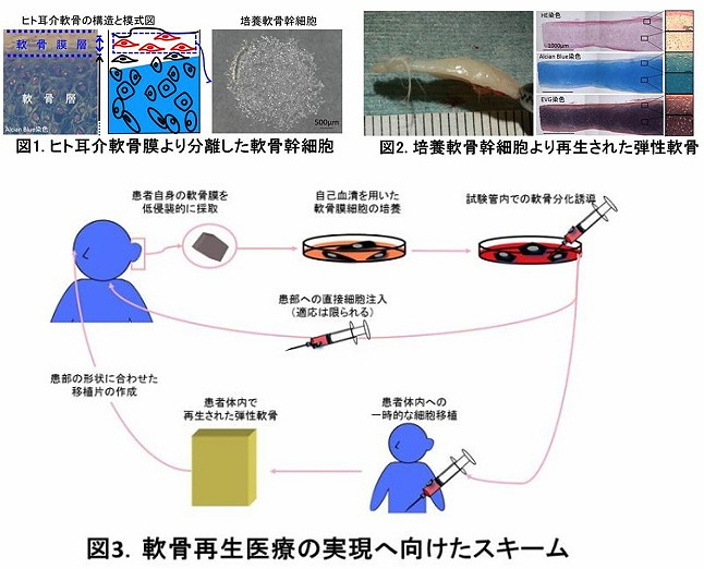 医学研究科の研究グループが ヒト耳介軟骨から幹細胞を発見 軟骨再生医療へ応用 Ycu 横浜市立大学