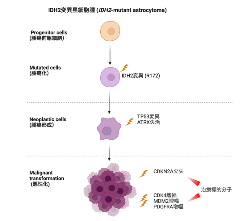 IDH2変異星細胞腫の進展様式