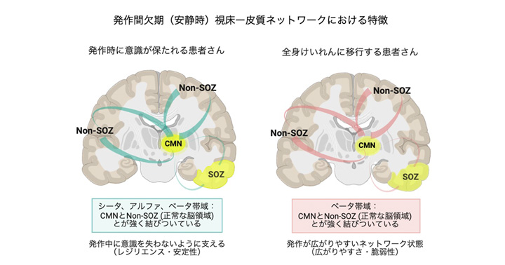 稀少 】てんかん発作時脳波アトラス 1987年発行 稀少 】てんかん発作時