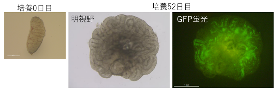胎仔精巣からの体外精子形成に成功～逆転写酵素阻害剤と低酸素培養で胎仔期からの精子発生プロセスを再現～