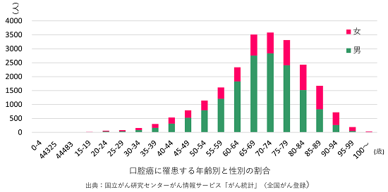 口腔癌に罹患する年齢別と性別の割合のグラフ