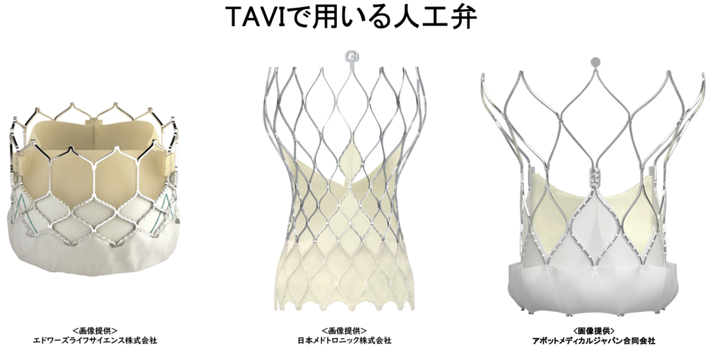 TAVIで用いる人工弁