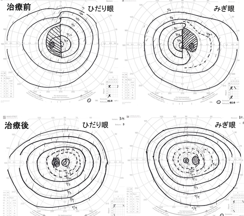 図1